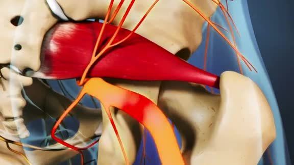 Síndrome del piramidal, falsa ciática o pseudociática - intouch fisioterapia y osteopatía